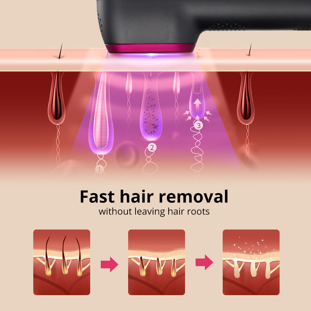 IPL Painless Laser Hair Removal Device 100000 Flashes Unisex
